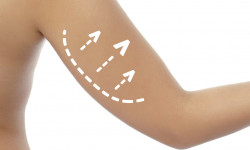 Підтяжка м'яких тканин плечей та рук Медицинский центр Alpha Cell Ровно