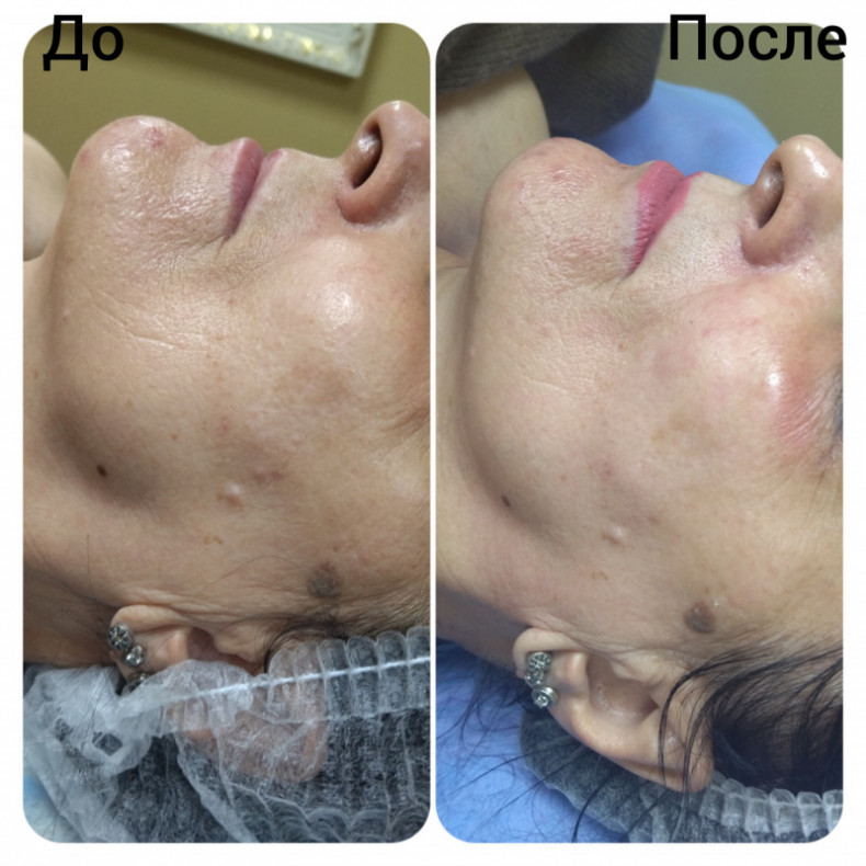 Скульптурирующий массаж лица, шеи и декольте, фото - Масажист Анна Юрьєва