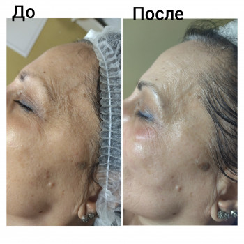 Скульптурирующий массаж лица, шеи и декольте