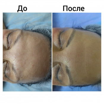 Скульптурирующий массаж лица, шеи и декольте