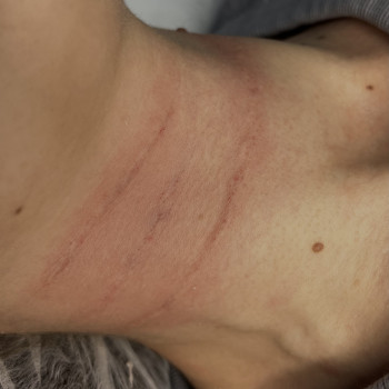 Інна Брейчак, Ужгород Фото - 6