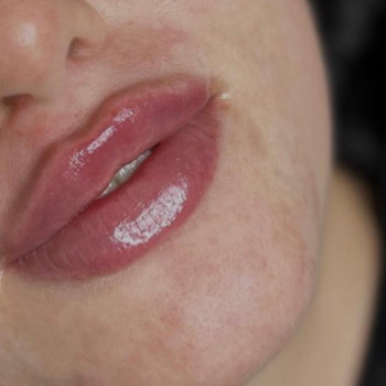 Інна Брейчак, Ужгород Фото - 7