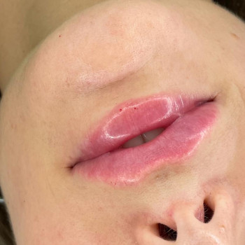 Інна Брейчак, Ужгород Фото - 8