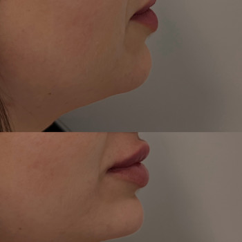 Інна Брейчак, Ужгород Фото - 9