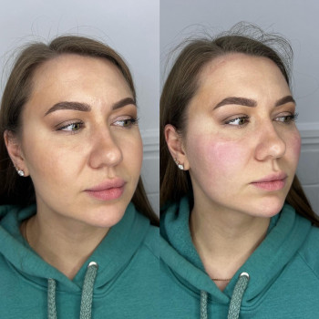 Інна Брейчак, Ужгород Фото - 10