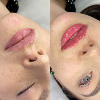 Інна Брейчак, Ужгород Фото - 11