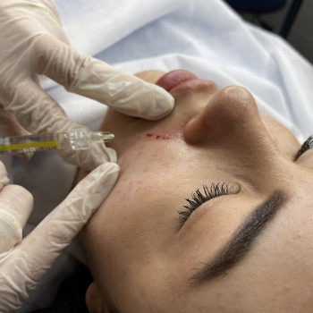 Інна Брейчак, Ужгород Фото - 13