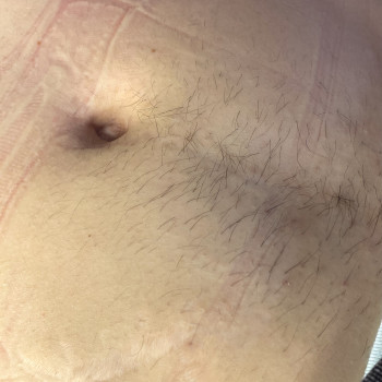 Депиляция
                    Мастер депиляции Юлия Житомир