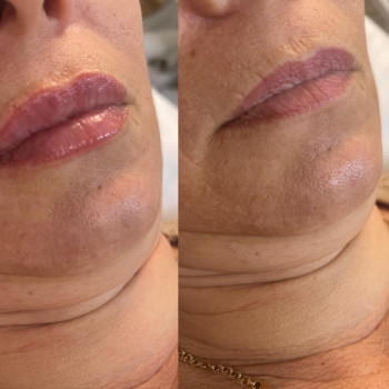 Наталія Караптан, Полтава Фото - 7