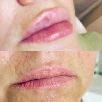 Наталія Караптан, Полтава Фото - 9