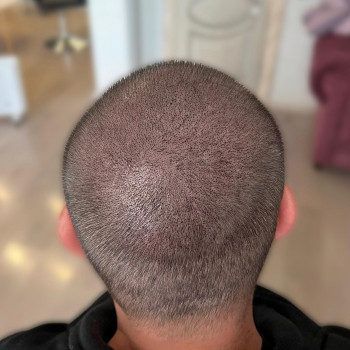 Трихопігментація
                    Мастер перманентного макияжа Ольга Днепр