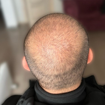 Трихопігментація
                    Мастер перманентного макияжа Ольга Днепр