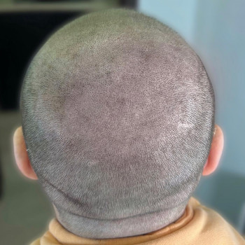 Трихопігментація
                    Мастер перманентного макияжа Ольга Днепр