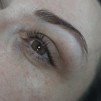 Після процедури