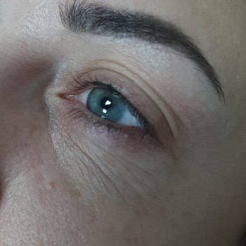 До процедури