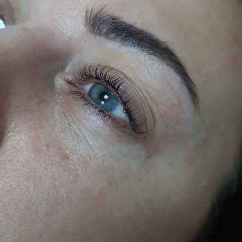 Після процедури