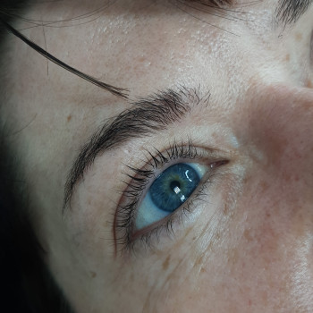 До процедури