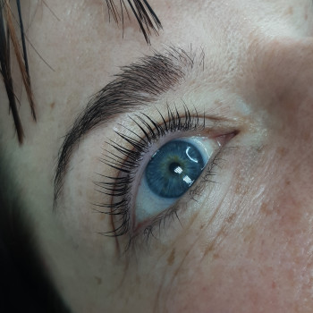 Після процедури