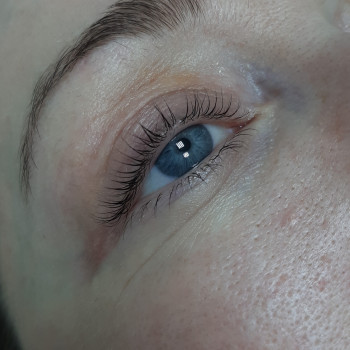 Після процедури