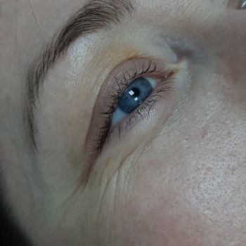 До процедури