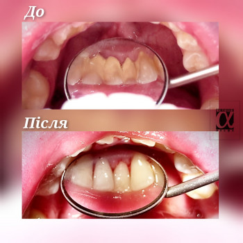 Альфа, Івано-Франківськ Фото - 17