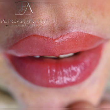 Анна Петровська, Буча Фото - 30