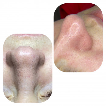 Вера Прудская, Бровары Фото - 52