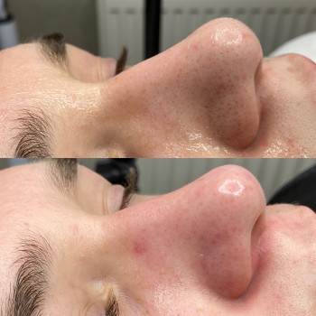 Вера Прудская, Бровары Фото - 53