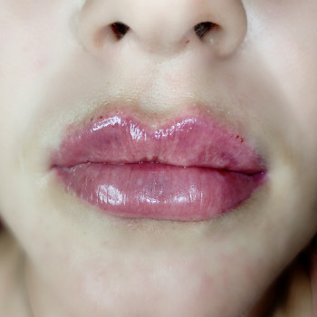 Сардиния 1 мл.