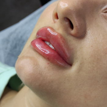 Сардиния 1мл.