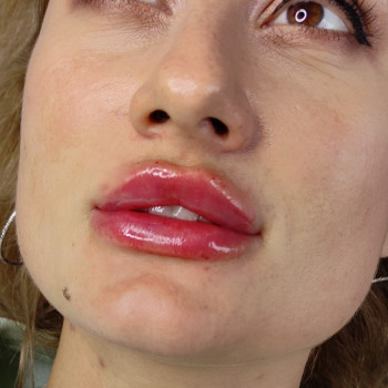 Сардиния 1 мл.