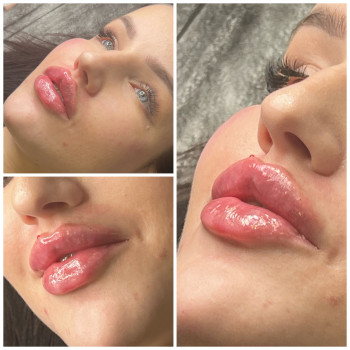 Наталья Грицай, Днепр Фото - 86