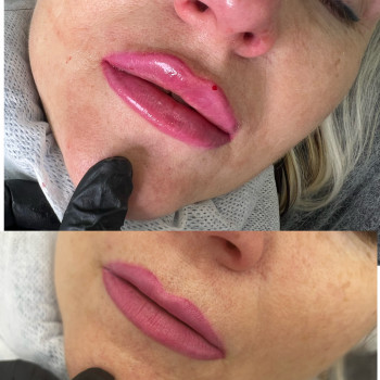 Наталья Грицай, Днепр Фото - 90