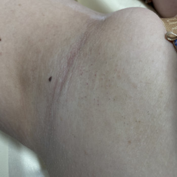 Ірина Климюк, Радомышль Фото - 5