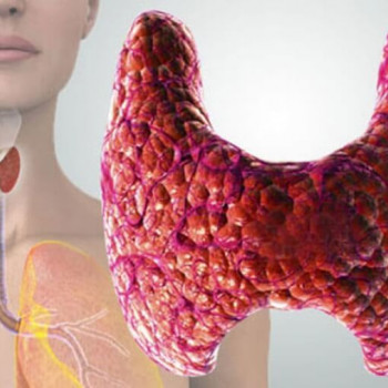 Гипотериоз щитовидной железы