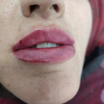 Ольга Мухина, Мелітополь Фото - 3