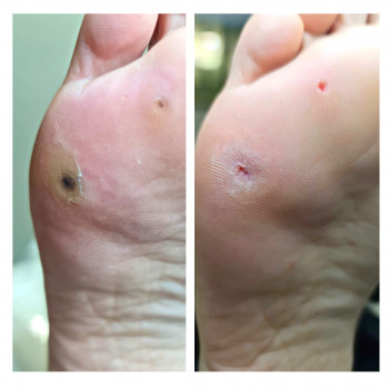 Руслана Петровна Гончарова, Одесса Фото - 66