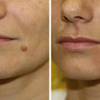 Art clinique, Киев Фото - 46