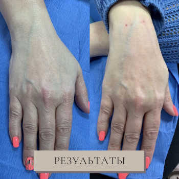 Контурная пластика
                    Дерматолог косметолог Алёна Николаев