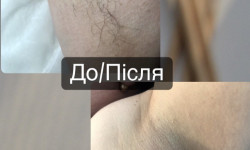 Депіляція Майстер депіляції Юлія Луцьк