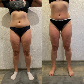 Андрій Теодорович, Житомир Фото - 11