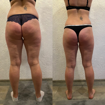 Андрій Теодорович, Житомир Фото - 10