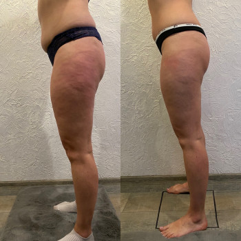 Андрій Теодорович, Житомир Фото - 9