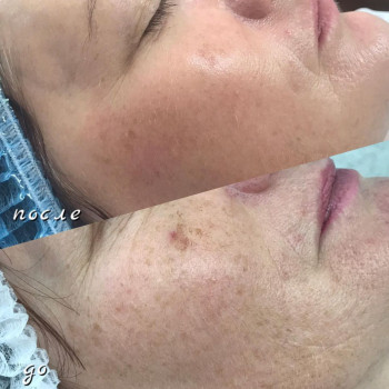 Ксения Просверякова, Павлоград Фото - 8