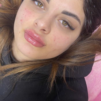 Збільшення губ
                    Мастер перманентного макияжа Лали Харьков