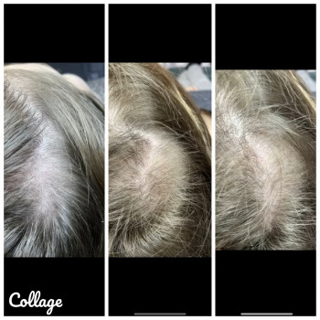 Христина Чорній, Тернополь Фото - 60