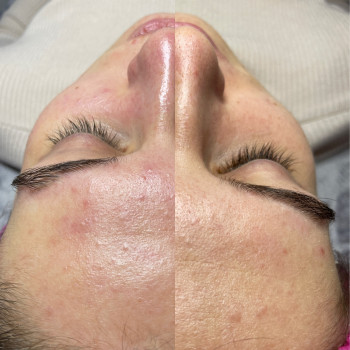 Христина Чорній, Тернополь Фото - 62