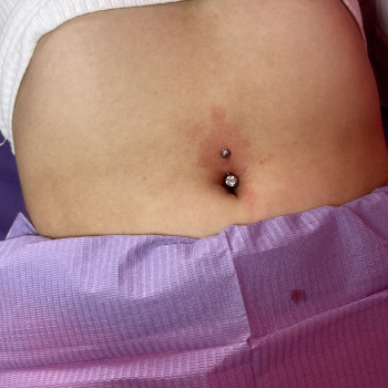 Христина Боднар, Ужгород Фото - 24