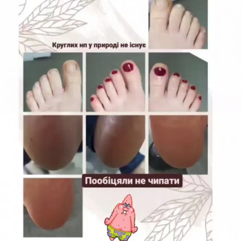 Педикюр апаратний, комбінований, медичний, підологічний
                    Подолог Ольга Днепр