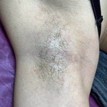 Тетяна Шейко, Охтирка Фото - 17